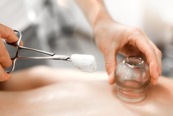 Detail of a woman therapist hands giving cupping treatment on back.